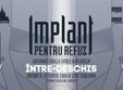 concert implant pentru refuz