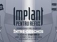 concert implant pentru refuz