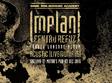 concert implant pentru refuz la suceava