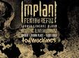 implant pentru refuz concert electric acustic